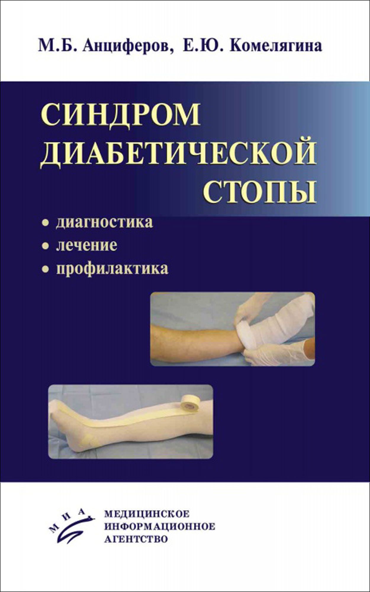 Диабетическая стопа клиника. Синдром диабетической стопы. Синдром диабетической стопы Анциферов. Диабетическая стопа лечение профилактика.