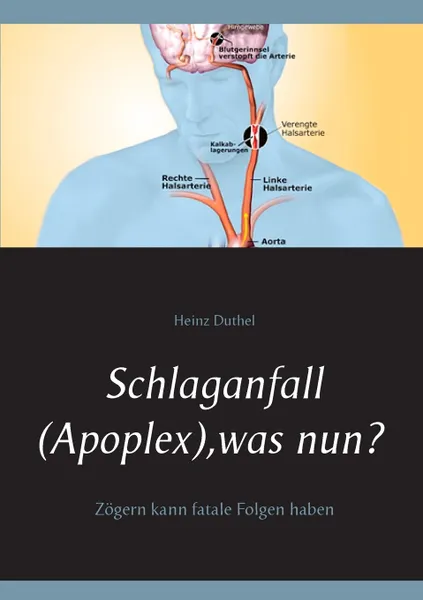 Обложка книги Schlaganfall (Apoplex), was nun?, Heinz Duthel