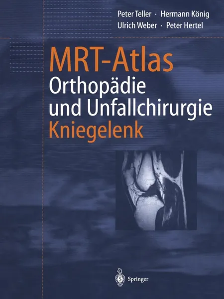 Обложка книги Mrt-Atlas Orthopadie Und Unfallchirurgie. Kniegelenk, Peter Teller, Hermann Konig, Ulrich Weber