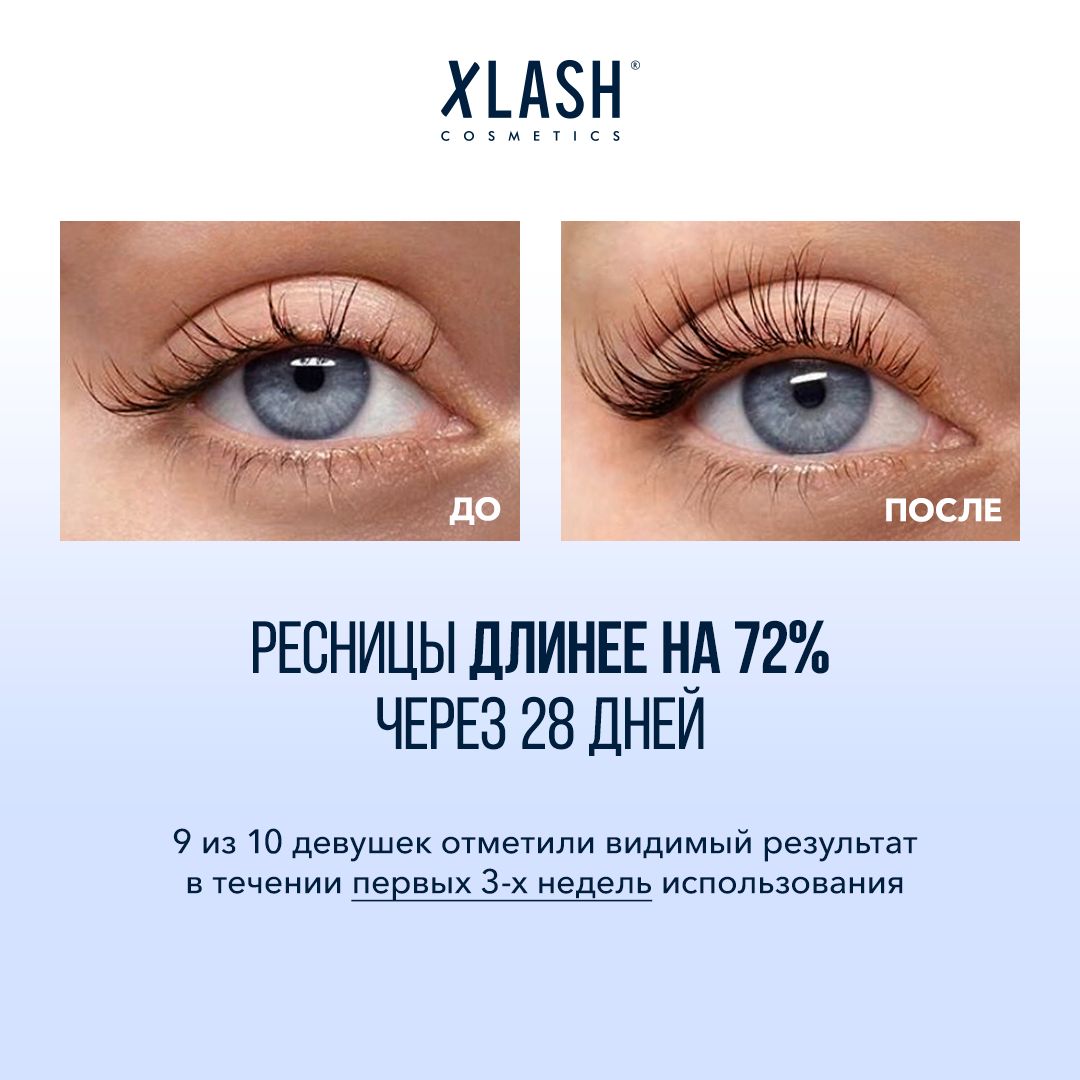 Для Роста Ресниц Отзывы С Фото