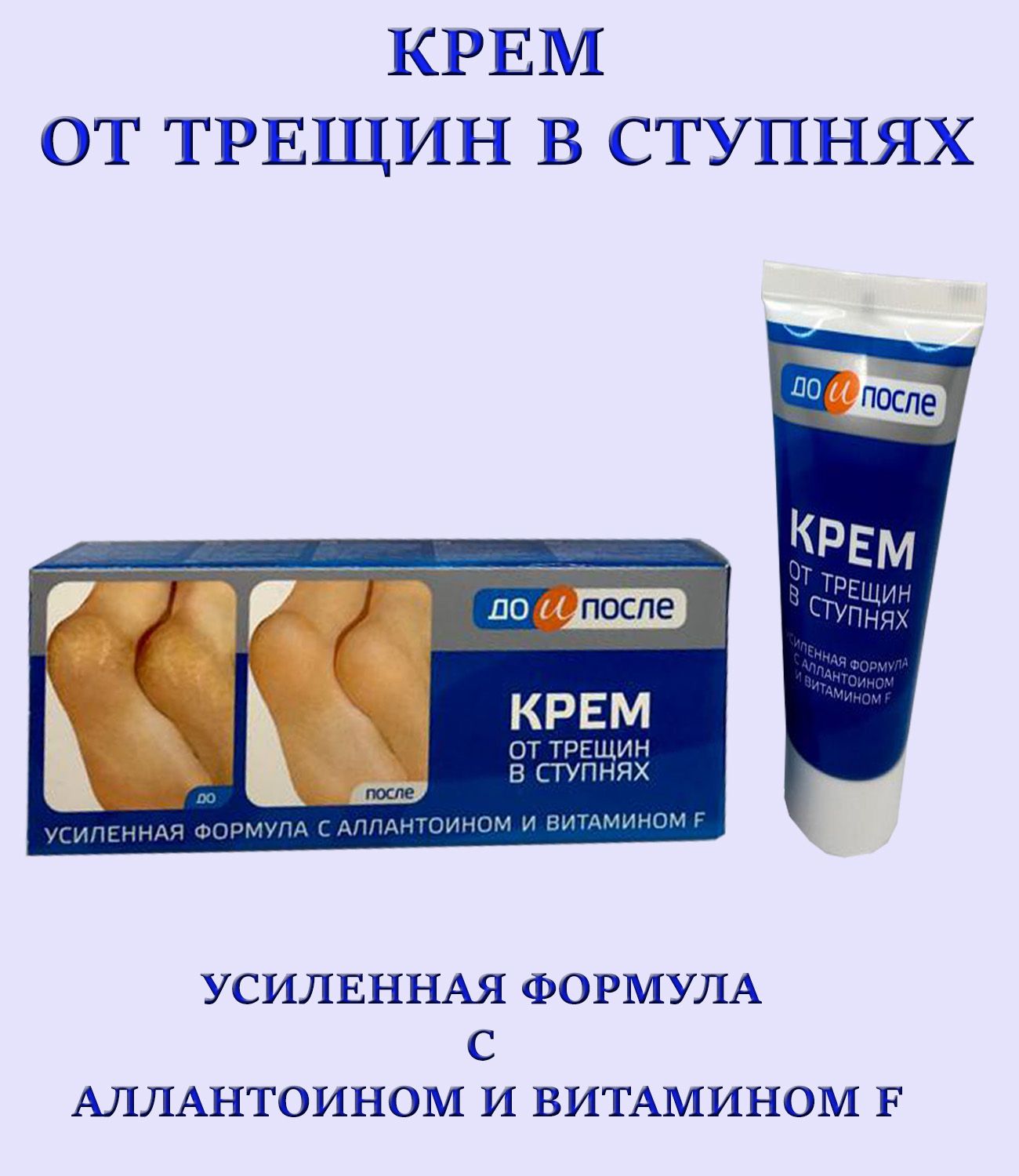 до и после крем от трещин в ступнях 150мл. крем для ног от трещин в ступнях. до и после крем от трещин в ступнях 150мл. крем для ног от трещин в ступнях «до и после», 50 мл. крем для ног от трещин в ступнях.