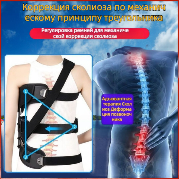 Характеристики Медицинский сколиозный фиксатор поясничного отдела ...