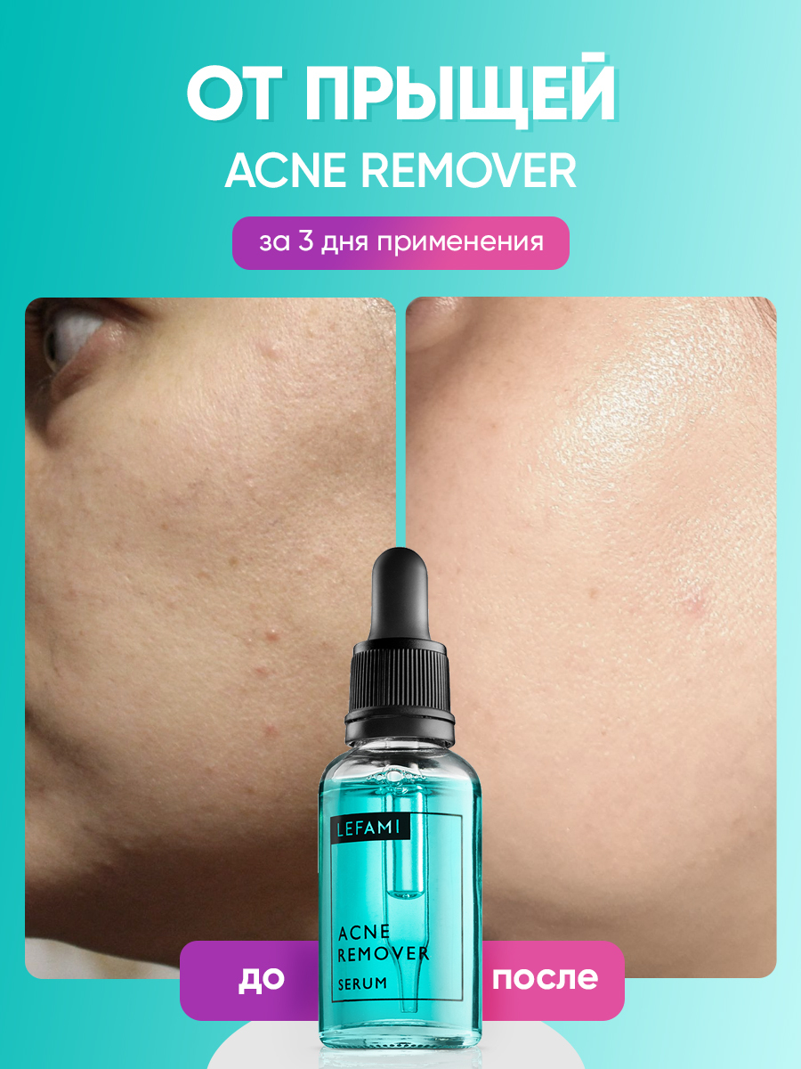 Lefami сыворотка. Lefami сыворотка от прыщей. Lefami acne Remover отзывы.