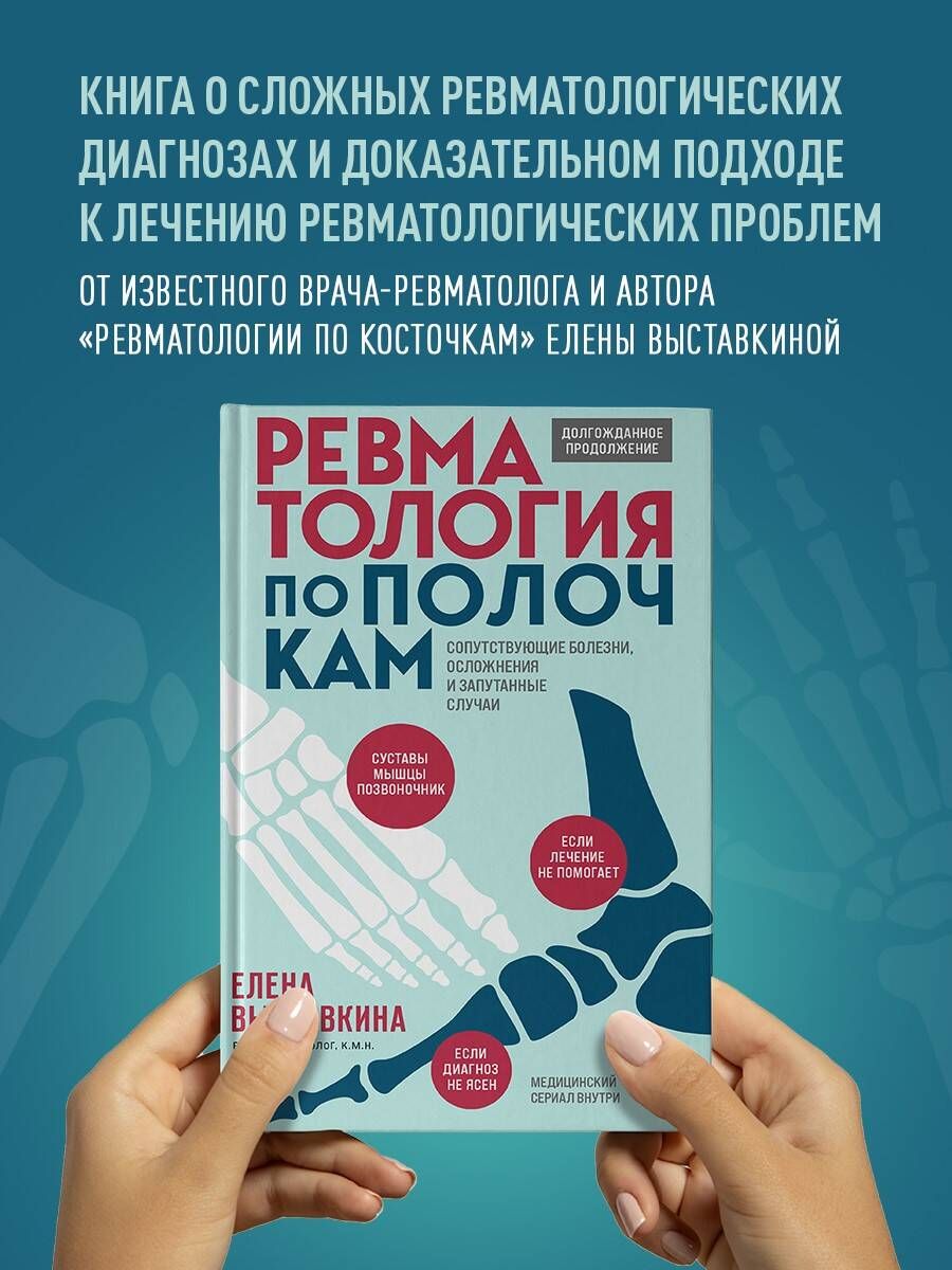 Ревматология по полочкам. Сопутствующие болезни, осложнения и запутанные  случаи - купить с доставкой по выгодным ценам в интернет-магазине OZON  (1185737508)