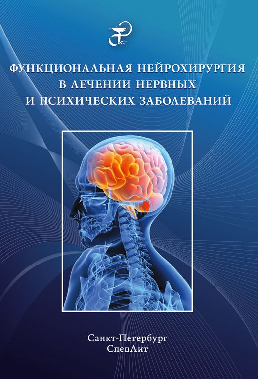 Функциональная нейрохирургия в лечении нервных и психических заболеваний