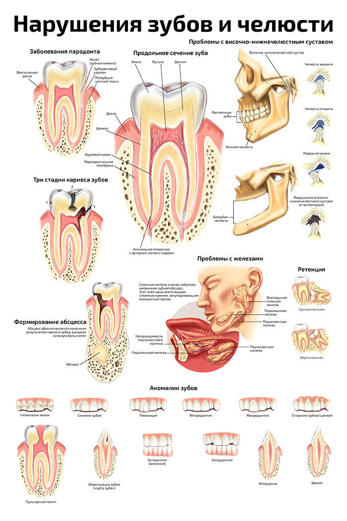 Plakat A2 Narusheniya Zubov I Chelyusti Anatomicheskij Plakat Kupit V Internet Magazine Ozon S Bystroj Dostavkoj