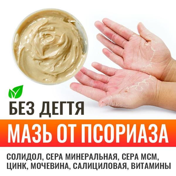 Мазь-крем солидоловый без дегтя 100гр с 2-мя видами серы, цинком ...