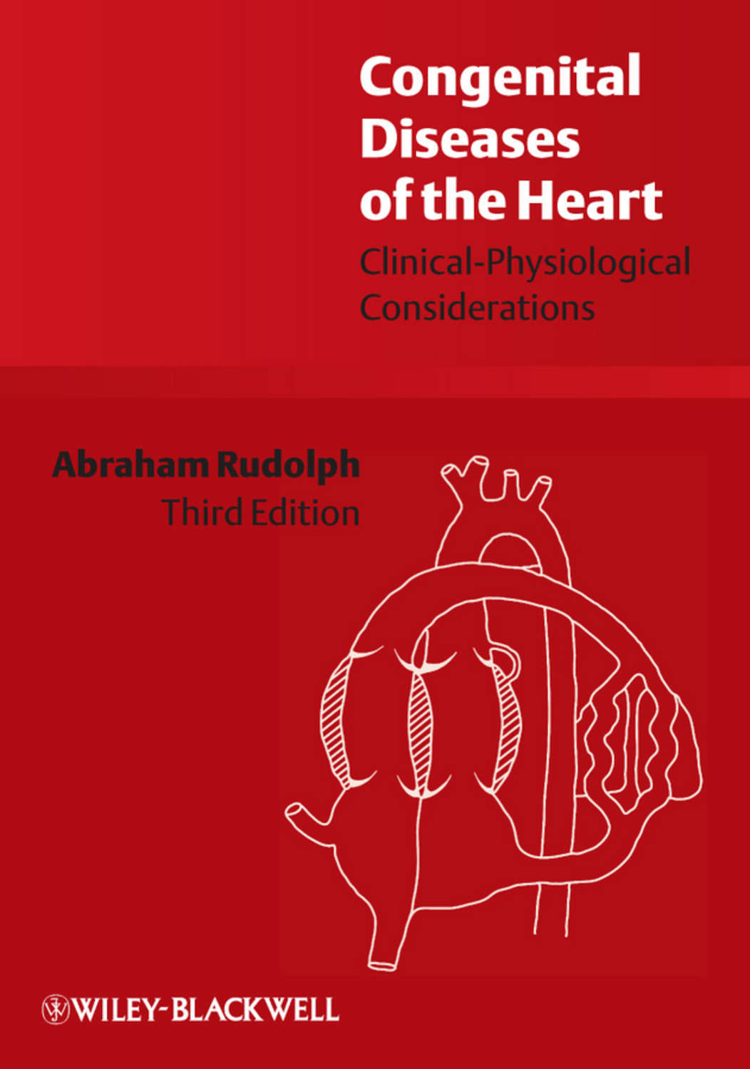 Дефект межжелудочной перегородки сердца. Congenital heart disease. Congenital heart disease. Congenital heart disease classification. Congenital heart disease.