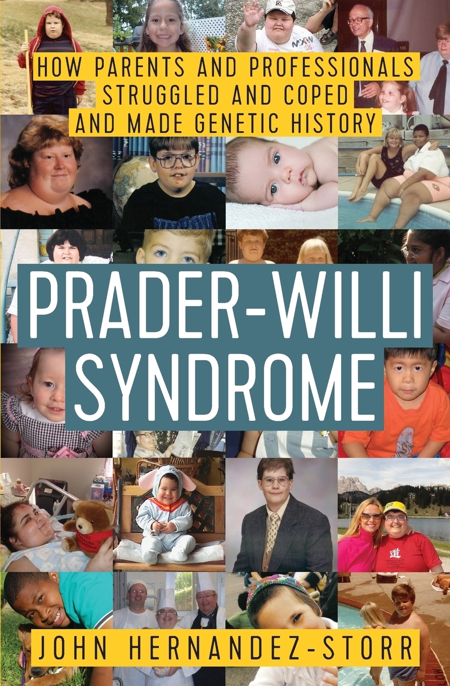 How your parents. Fish Analysis Prader Willi Syndrome.