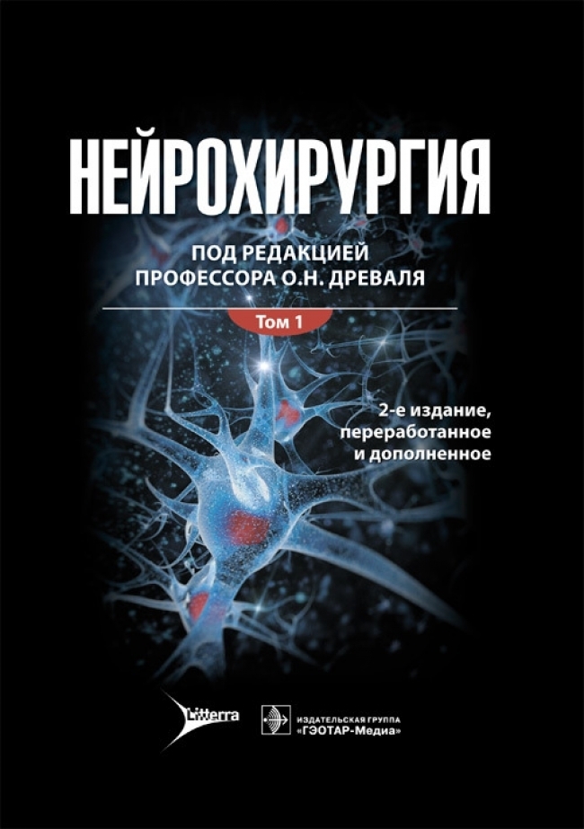 Нейрохирургия рекомендации. Книги по нейрохирургии. Древаль нейрохирургия. Журнал нейрохирургия.