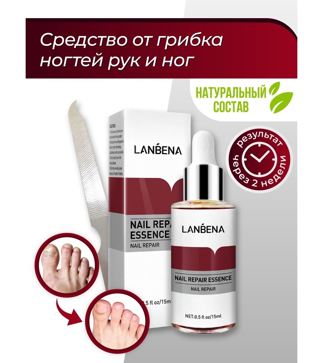 Капли для ногтей от грибка. Средство от грибка ногтей LANBENA Nail Repair Essence 15 ml. LANBENA Nail Repair Essence от грибка ногтей. Средство от грибка ногтей на ногах Nail Repair Essence. LANBENA сыворотка для ногтей.