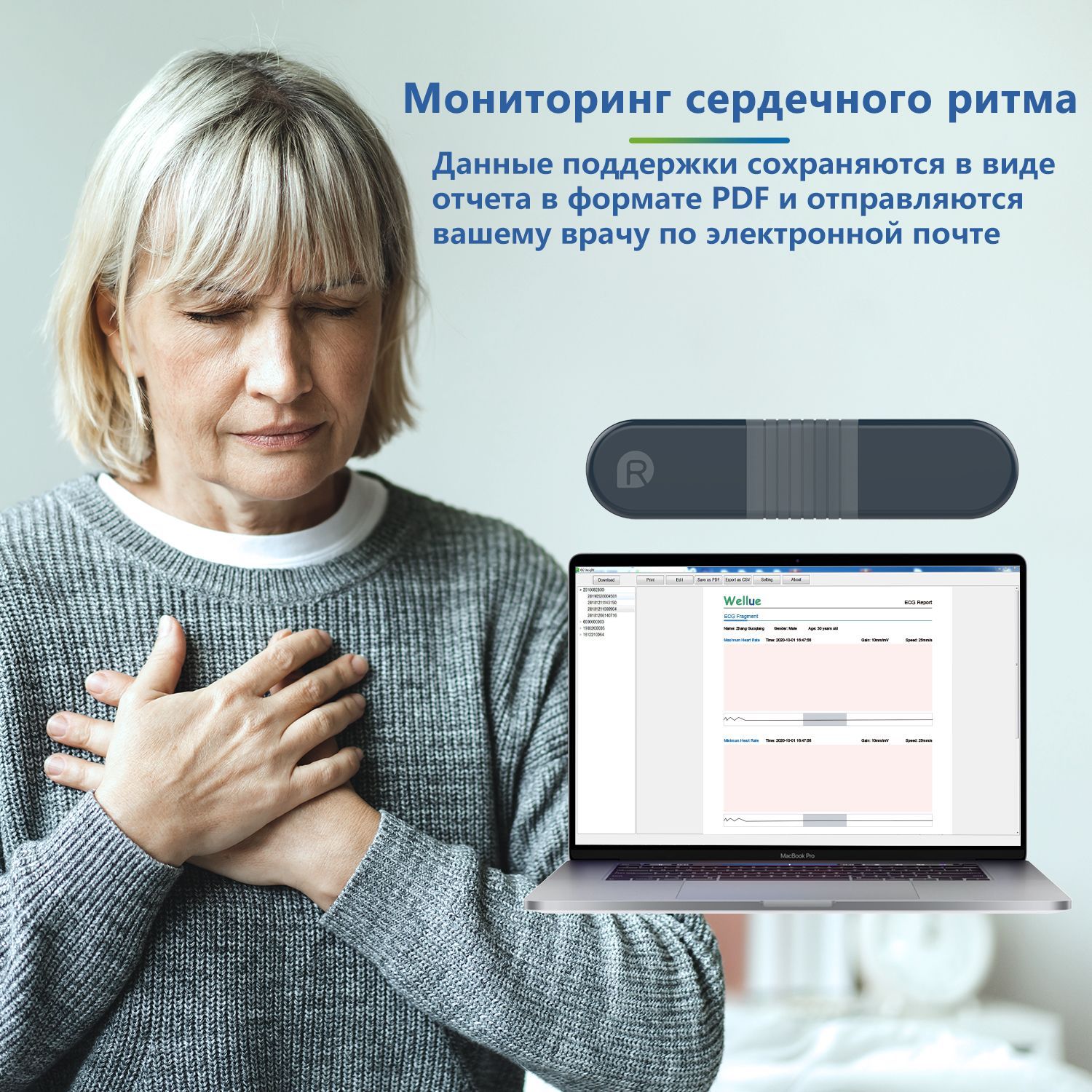 Поддерживающий интеллект. ЭКГ монитор