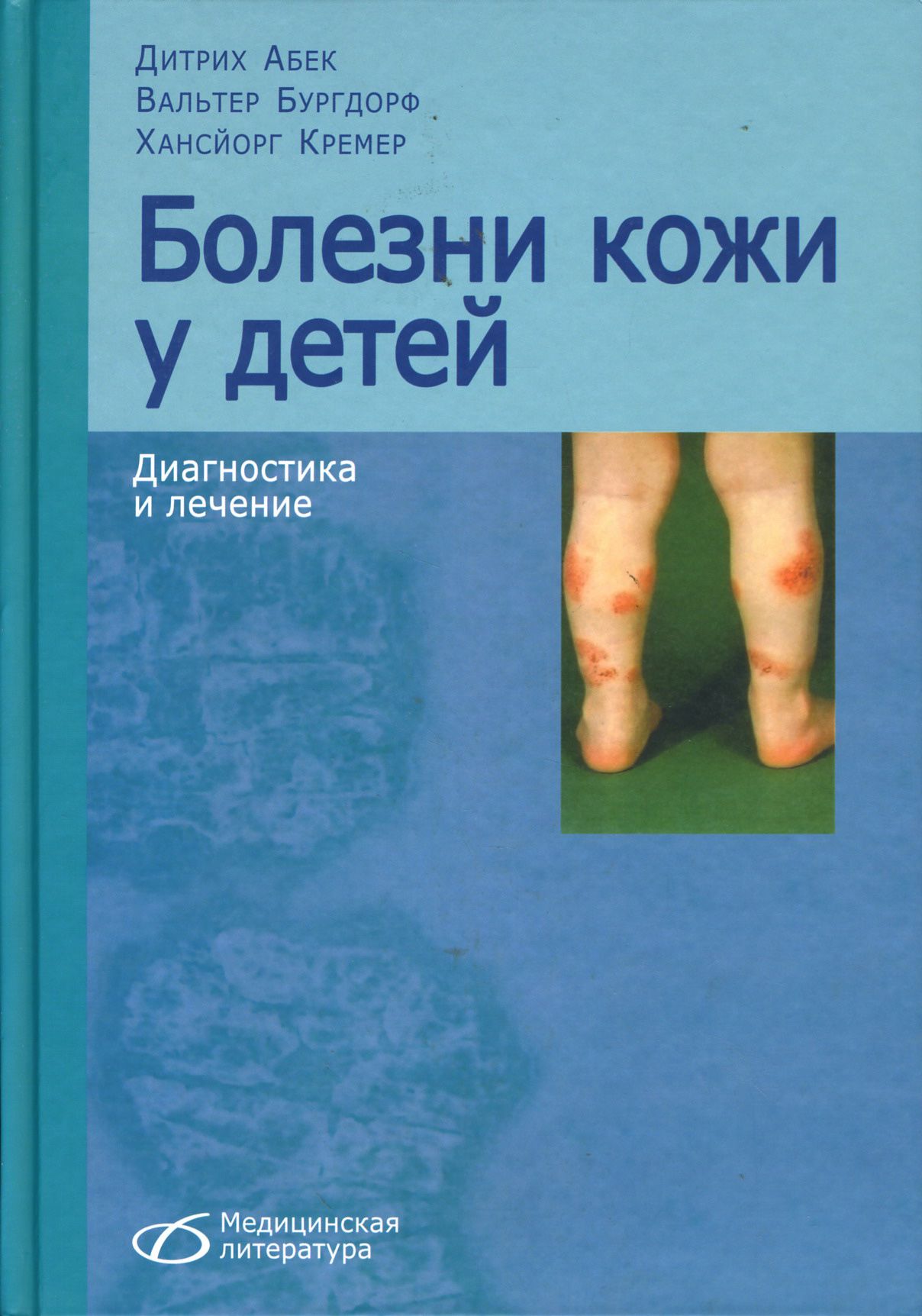 Фото Болезней Кожи У Детей