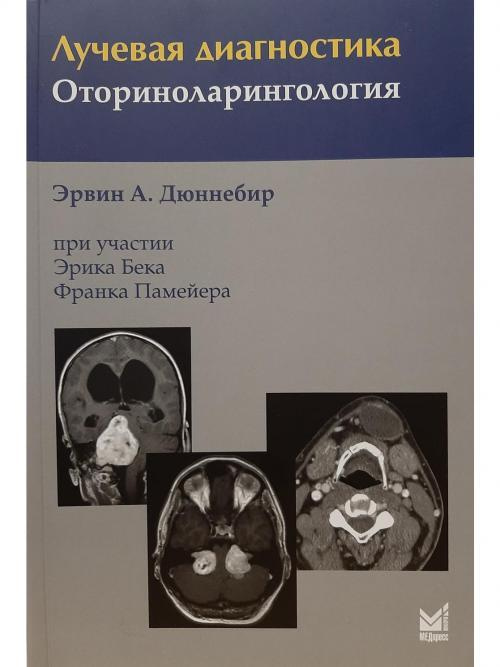 Лучевая диагностика в оториноларингологии и офтальмологии презентация