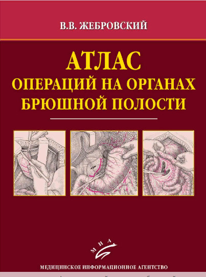 атлас хирургических операций