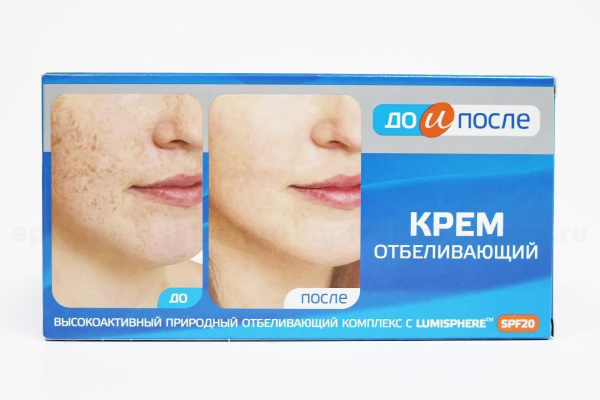 До и после пигментных пятен отзывы До и после Крем отбеливающий 100мл - купить с доставкой по выгодным ценам в инте