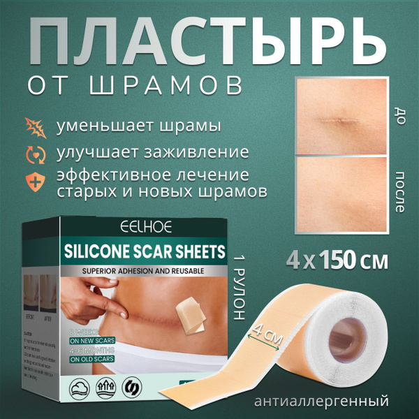 Пластырь силиконовый от шрамов и рубцов 4х150 см. дерматикс ...