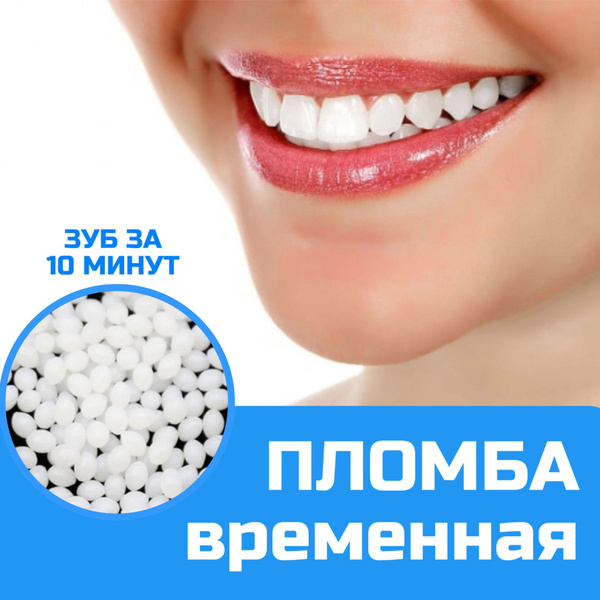 Временная пломба для зуба. Виниры для зубов накладные верхние и нижние ...