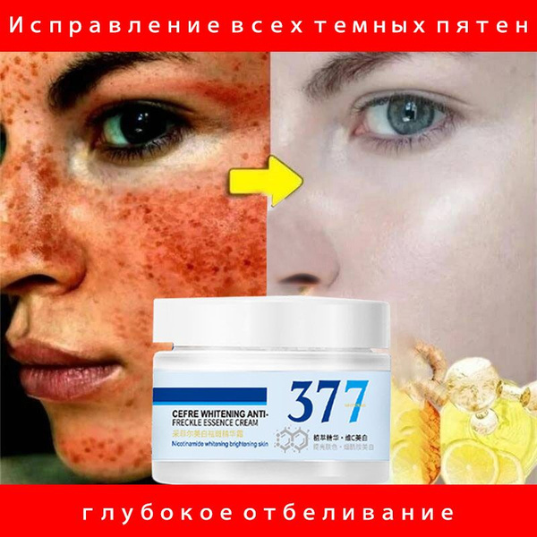 Отбеливающий крем для лица/против пигментации,Увлажняющий, осветляющий ...