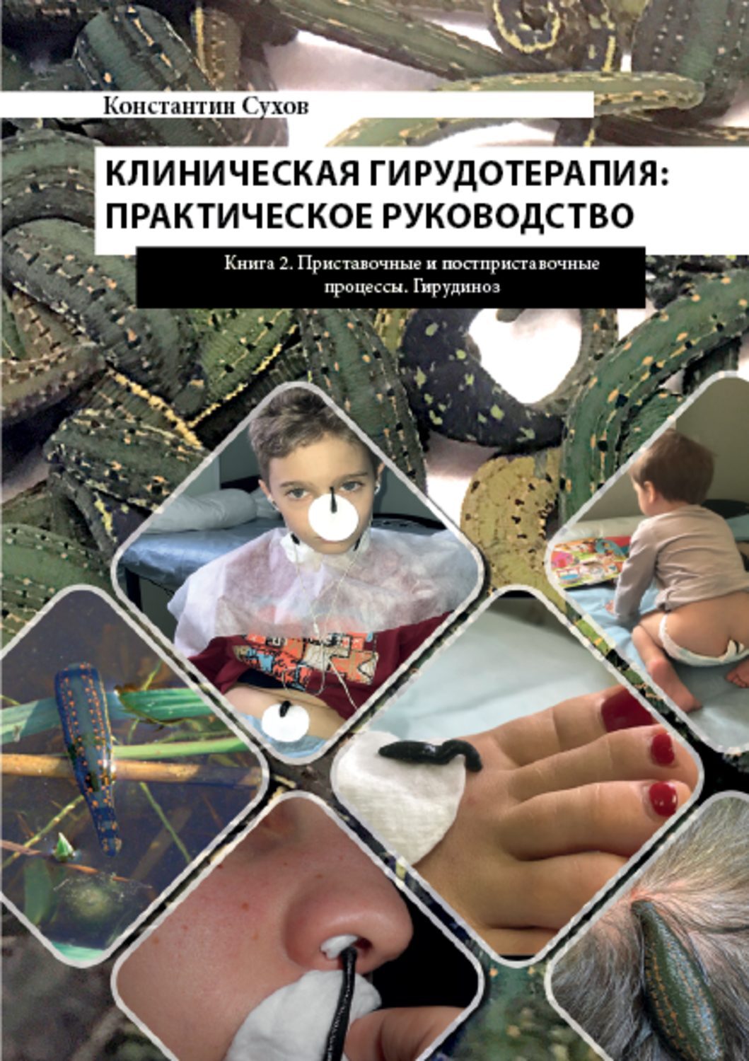 Купить Книгу Лечение Пиявками