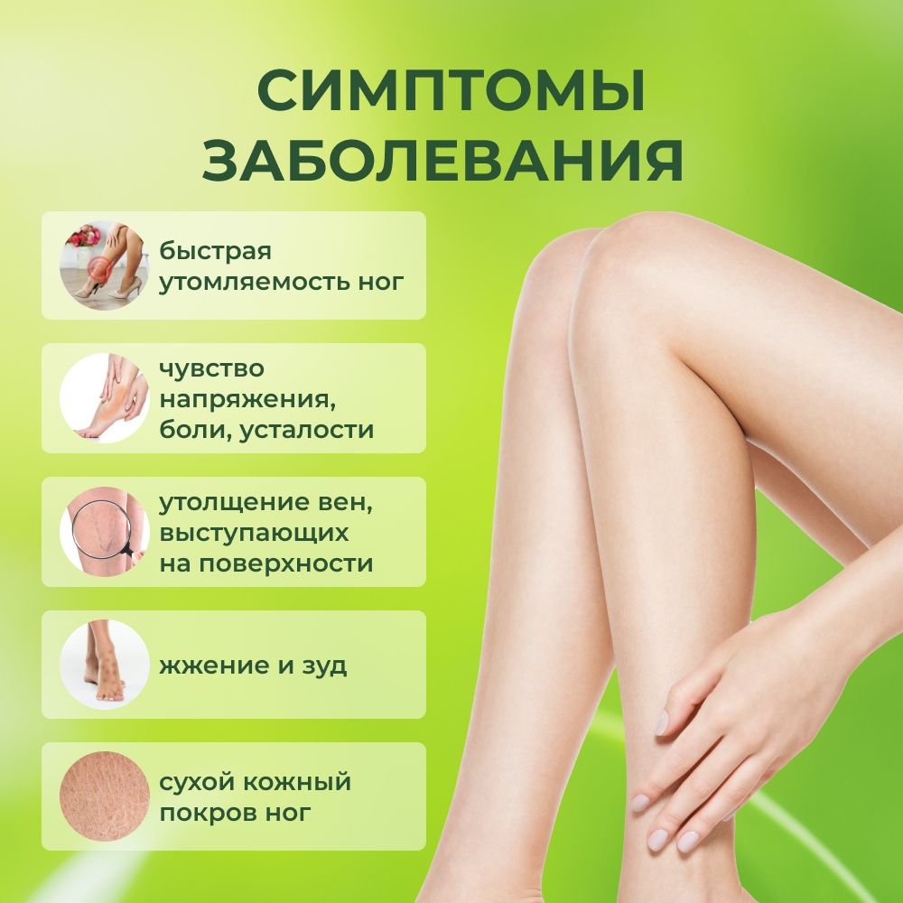 гель венорем от вен. венорем мазь от варикозных вен. Varitonus варитонус. варитонус. хорошая мазь от варикоза на ногах.
