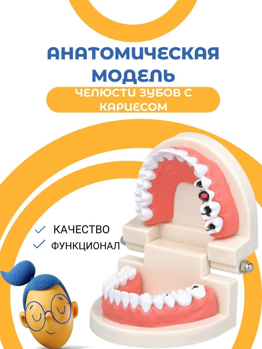 Анатомическая модель зубов, Зубная челюсть с кариесом / 3Д зубы для  демонстрации и игры в доктора стоматолога - купить с доставкой по выгодным  ценам в интернет-магазине OZON (949090908)