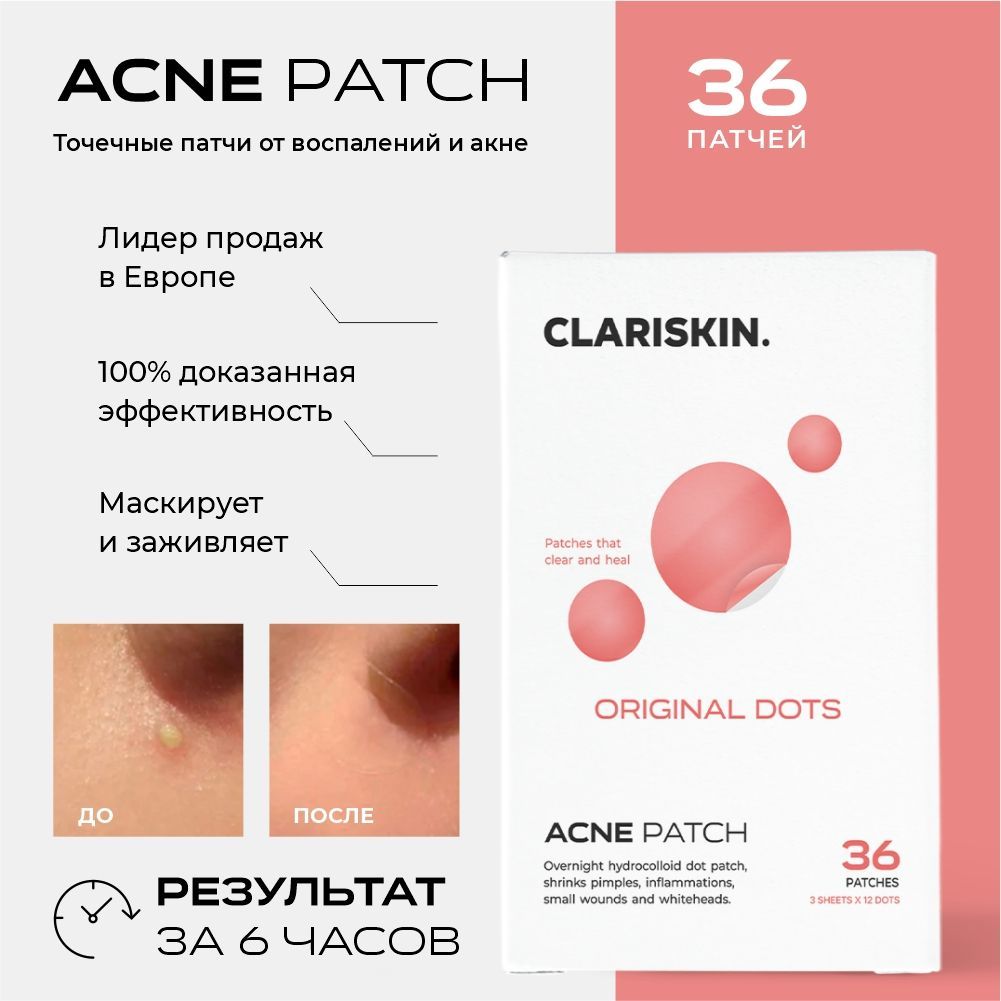 ПатчиотпрыщейиакнеClariskinACNEPATCH36шт.OriginalDotsточечныепатчи