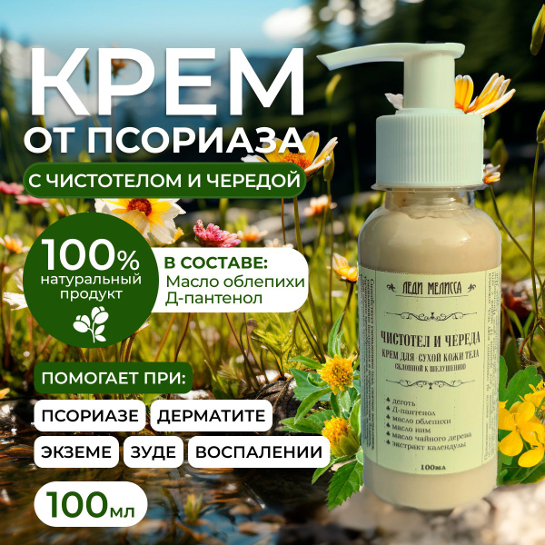 Крем мазь от псориаза, дерматита, зуда и экземы "Чистотел и Череда ...