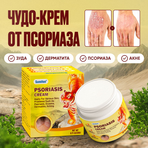 Чудо мазь полиостеоартроз. Китайская чудо мазь от псориаза, экземы, дерматита, 15 гр - купить с. Мазь Крем от ПСОРИАЗА, экземы, атопического дерматита / Китайская чудо. Полиостеоартроз МКБ-10 у взрослых: что это за болезнь и как лечить.