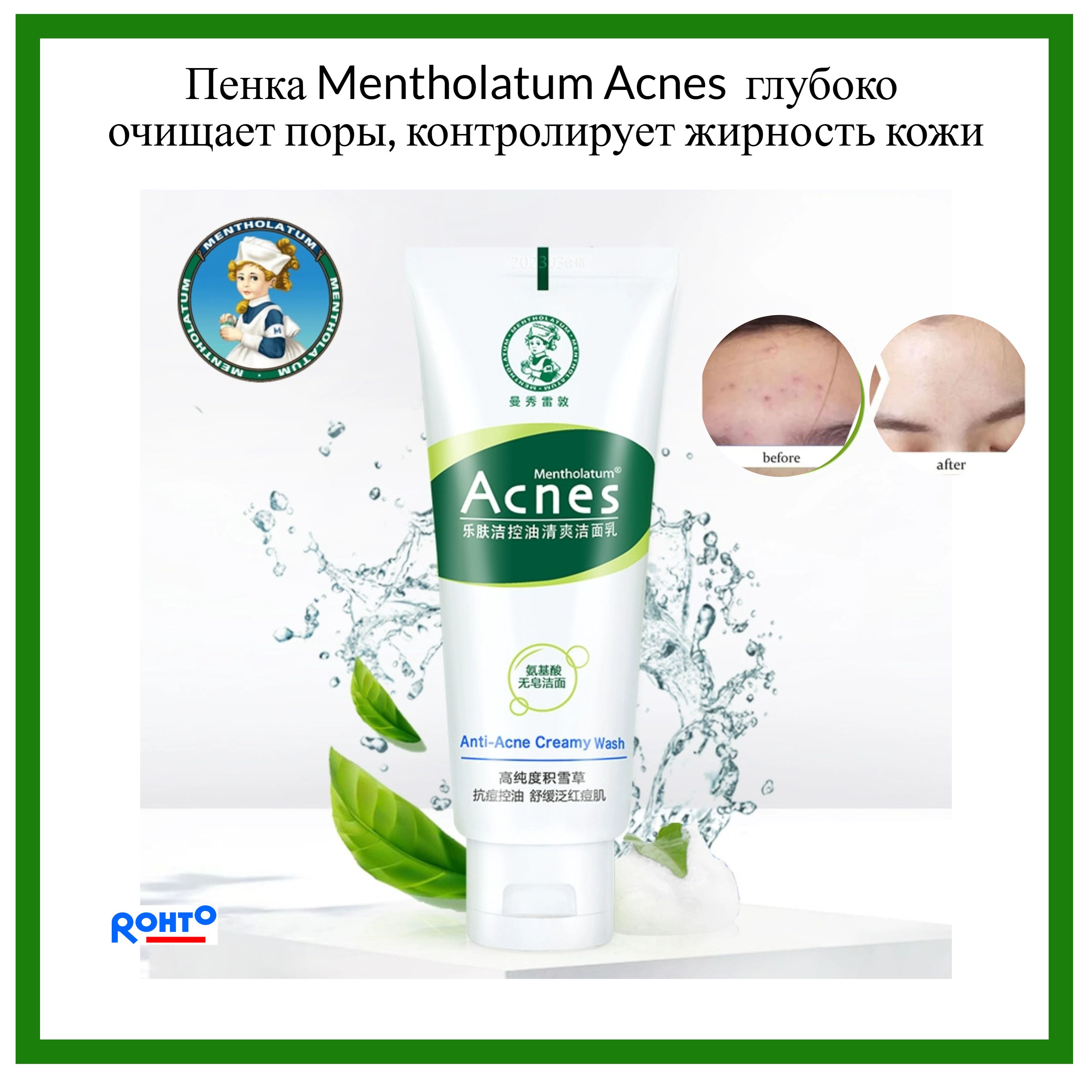 MENTHOLATUM ACNES Пенка для умывания лица против акне 100 g/ кремовая консистенция/ Rohto Japan