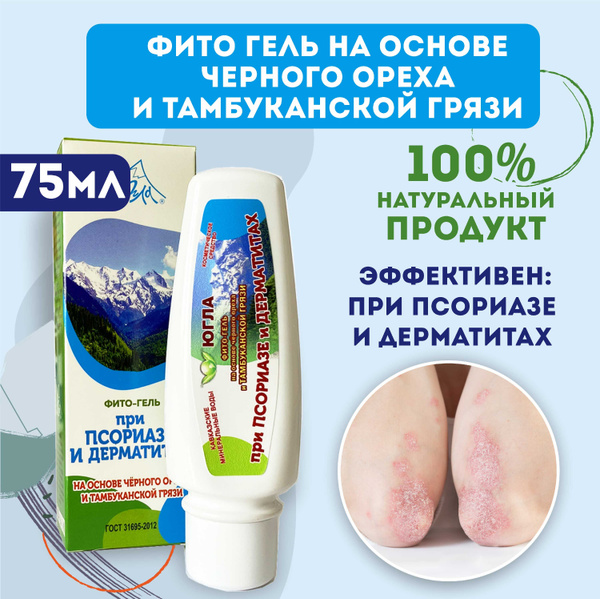 ЮГЛА Гель с вытяжкой из Тамбуканской грязи от псориаза и болезней кожи ...