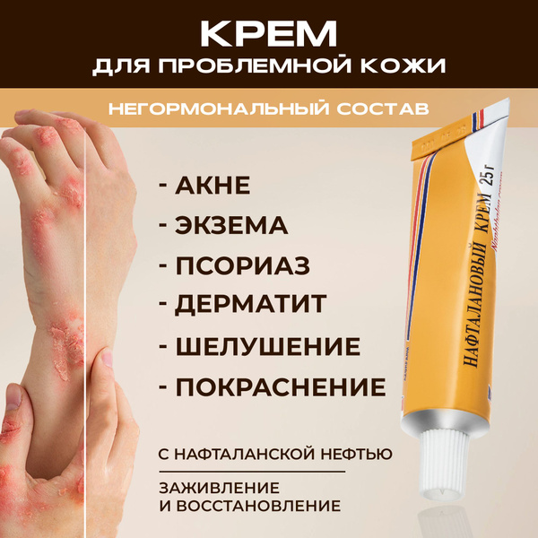 Нафталановый Крем от псориаза, дерматита, шелушений и зуда для тела ...