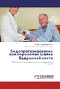 Эндопротезирование при переломах шейки бедренной кости - Марат Худайбергенов, Вячеслав Васильевич Ключевский