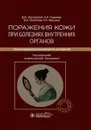 Поражения кожи при болезнях внутренних органов. Иллюстрированное руководство для врачей - Д. В. Заславский, А. А. Сыдиков, В. А. Охлопков, Р. А. Насыров