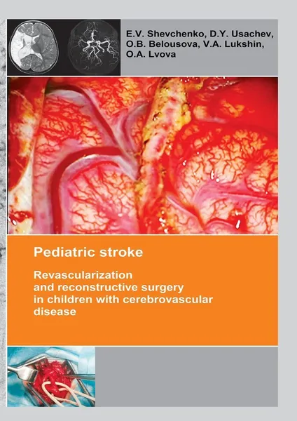 Обложка книги Pediatric stroke, E. Shevchenko