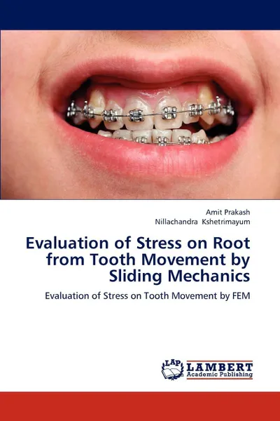 Обложка книги Evaluation of Stress on Root from Tooth Movement by Sliding Mechanics, Amit Prakash, Nillachandra Kshetrimayum