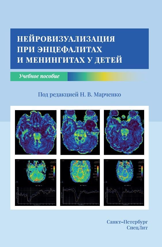 Нейровизуализация при энцефалитах и менингитах у детей | Марченко Наталья Викторовна