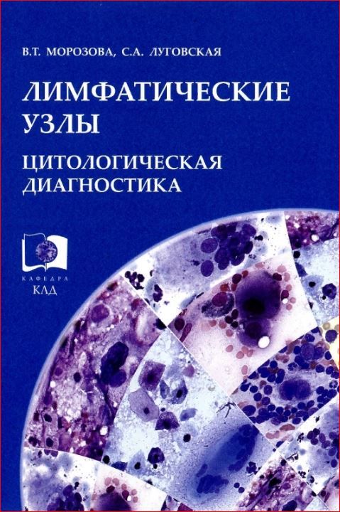 Лимфатические узлы. Цитологическая диагностика | Луговская Светлана Алексеевна