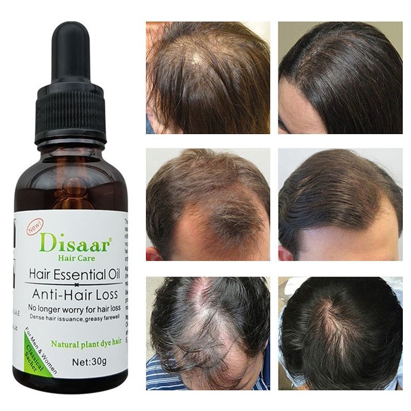 Disaar/ Восстановление волос, уход за кожей головы, массаж, эфирные масладля ухода за волосами 30 мл - купить с доставкой по выгодным ценам винтернет-магазине OZON (851703939)