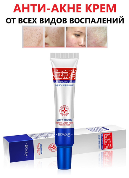 Анти-акне крем от прыщей anti-acne точечный, маска от черных точек акне ...