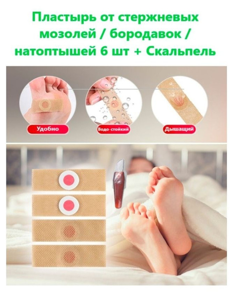 Пластырь мозольный 98994368, 6 шт. — купить в интернет-магазине OZON с ...