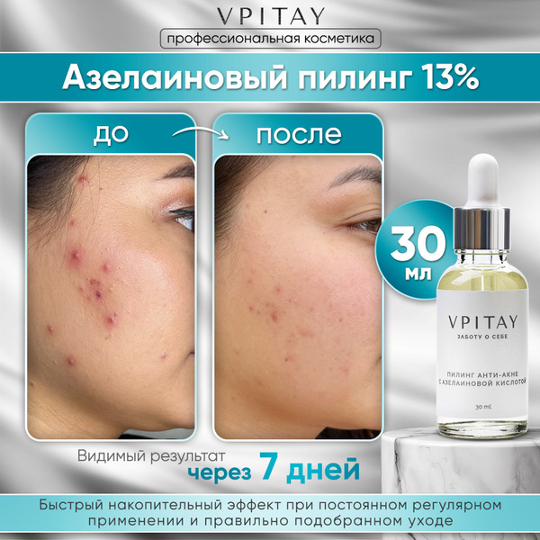 Пилинг для лица профессиональный с азелаиновой кислотой анти акне ...