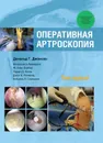 Оперативная артроскопия. Том 1 - Д. Г. Джонсон, А. Амендола, Ф. А. Барбер