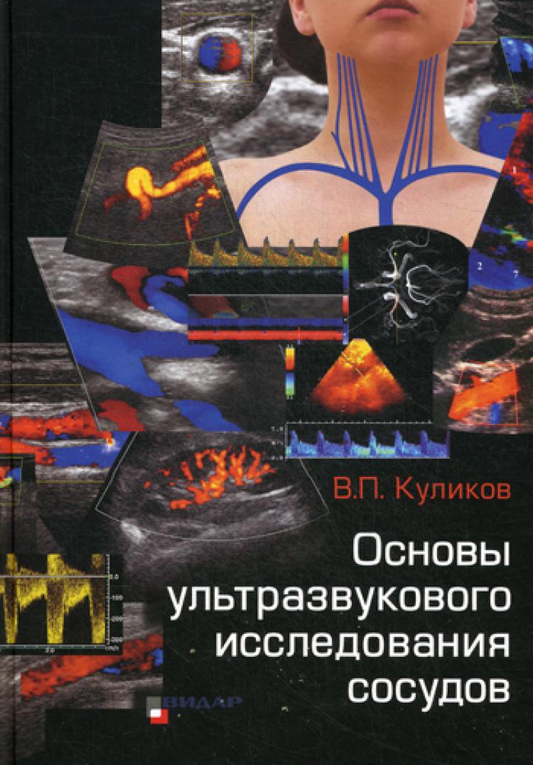 Основы ультразвукового исследования сосудов | Куликов Виктор Павлович -  купить с доставкой по выгодным ценам в интернет-магазине OZON (310228607)