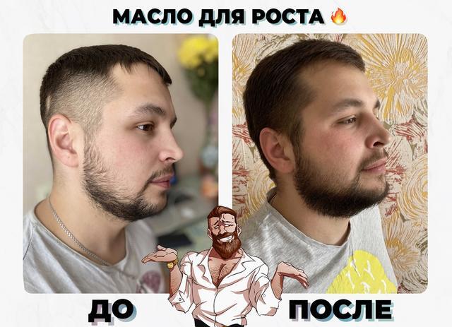 Способ применения масел для роста бороды