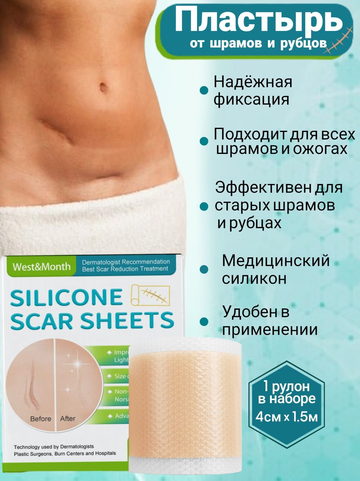 Силиконовый пластырь от шрамов и рубцов West & Month 4x150 см - купить с  доставкой по выгодным ценам в интернет-магазине OZON (1115908430)