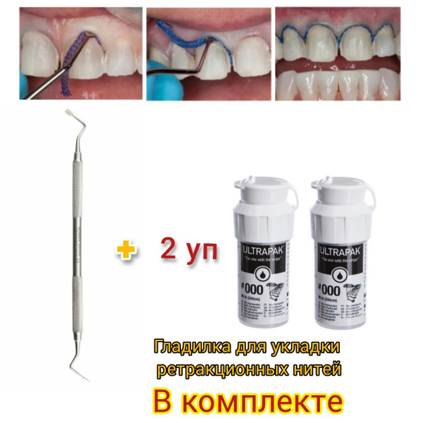 Набор 2 уп , НИТЬ РЕТРАКЦИОННАЯ ULTRAPAK (УЛЬТРАПАК) #000 (244 см ...