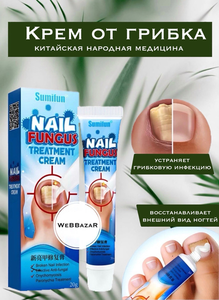 Эффективный крем от грибка ногтей Sumifun, устранение инфекции и ...
