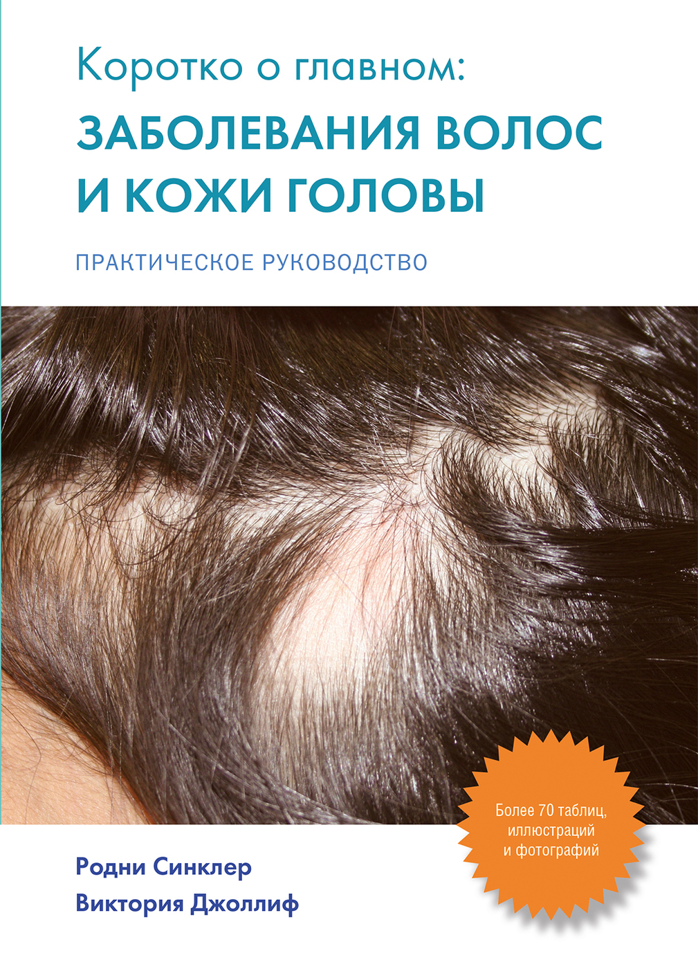 Заболевание кожи головы фото лечение Коротко о главном. Заболевания волос и кожи головы. Практическое руководство Син