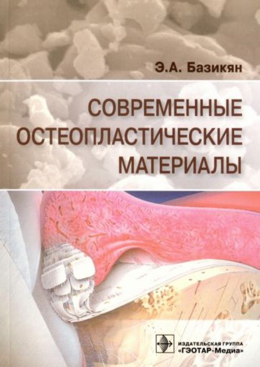 Материалы читать. Современные остеопластические материалы Базикян э.а.. Остеопластический материал. Современные представления об остеопластических материалах. Классификация современных остеопластических материалов.